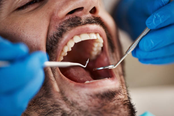Best Emergency Treatment for Oral Infections in Lisbon Falls, ME